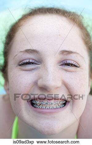 Stock Photography - Girl with dental braces. Fotosearch