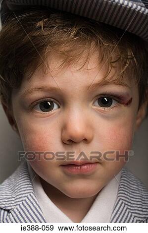 Stock Photo - Boy with an injury. Fotosearch