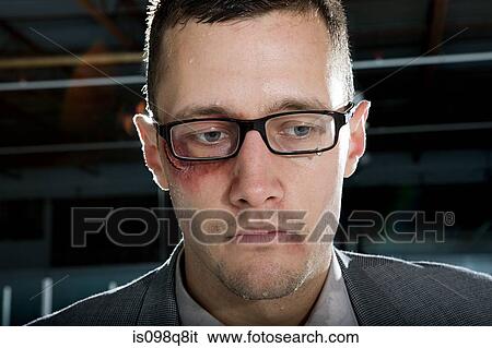 Businessman with a bruised eye View Large Photo Image Stock Photograph - Businessman with a bruised eye. Fotosearch