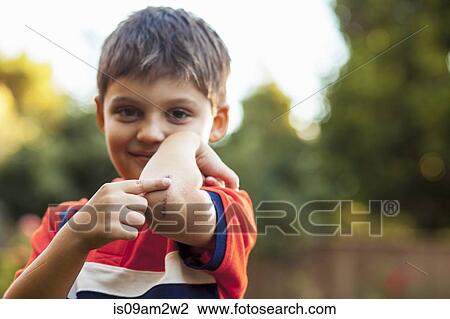Boy pointing at bruise on elbow View Large Photo Image Stock Image - Boy pointing at bruise on elbow. Fotosearch