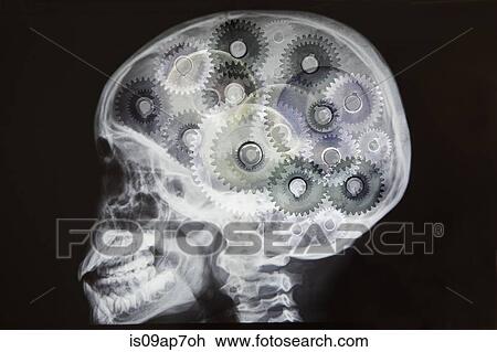 "X-ray of skull with cogs as brain, digital montage" View Large Photo Image Stock Image - "X-ray of skull with cogs as brain, digital montage". Fotosearch