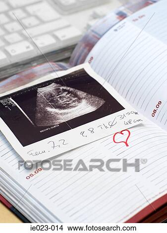 Picture - Ultrasound scan in a diary. Fotosearch