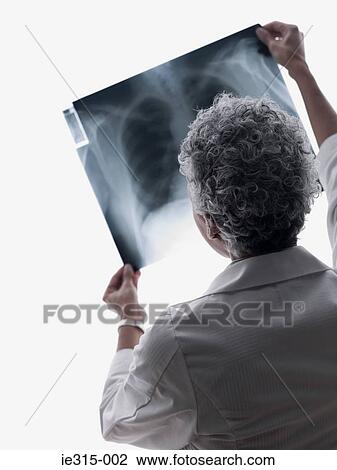 Doctor looking at an x-ray View Large Photo Image Stock Image - Doctor looking at an x-ray. Fotosearch