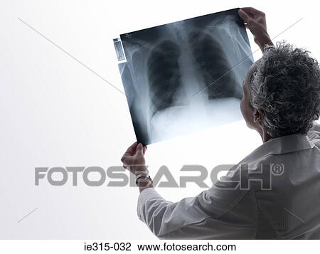 Stock Image - Doctor looking at an x-ray. Fotosearch