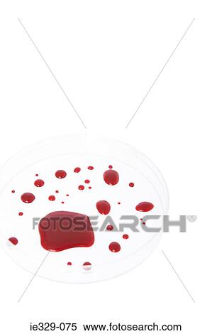 Blood on a petri dish View Large Photo Image Stock Photography - Blood on a petri dish. Fotosearch