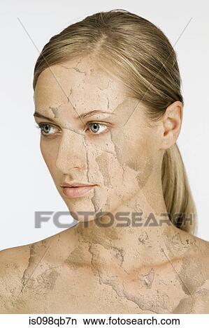 Woman with cracked and peeling skin View Large Photo Image Picture - Woman with cracked and peeling skin. Fotosearch