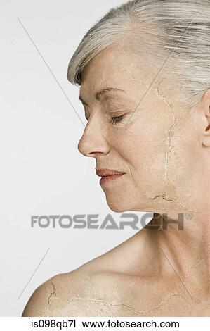 Woman with cracked and peeling skin View Large Photo Image Stock Image - Woman with cracked and peeling skin. Fotosearch