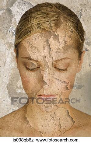 Woman with cracked and peeling skin View Large Photo Image Stock Photo - Woman with cracked and peeling skin. Fotosearch