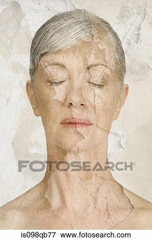 Stock Photo - Woman with cracked and peeling skin. Fotosearch