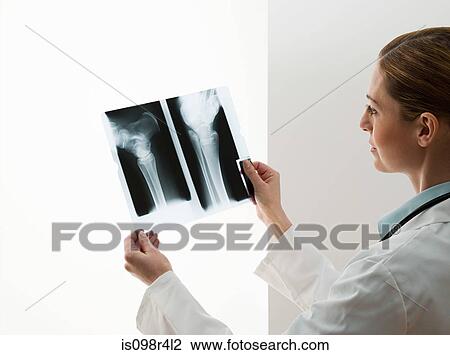 Stock Image - Female doctors looking at x-rays. Fotosearch