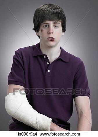 Boy with arm in plaster View Large Photo Image Picture - Boy with arm in plaster. Fotosearch