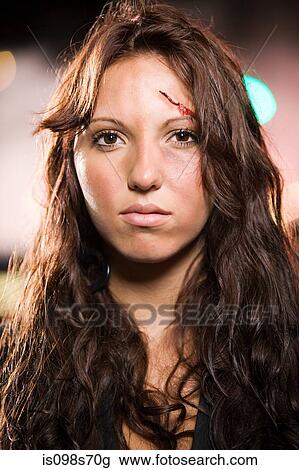 Teenage girl with facial injuries View Large Photo Image Stock Image - Teenage girl with facial injuries. Fotosearch