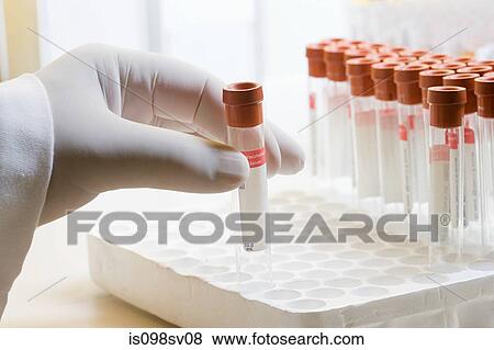 Hand and test tubes View Large Photo Image Stock Photo - Hand and test tubes. Fotosearch