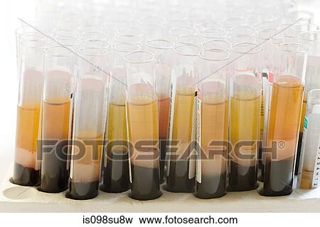 Liquid in test tubes View Large Photo Image Stock Photo - Liquid in test tubes. Fotosearch