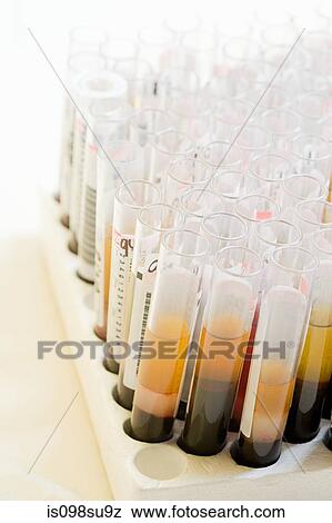 Liquid in test tubes View Large Photo Image Stock Photo - Liquid in test tubes. Fotosearch