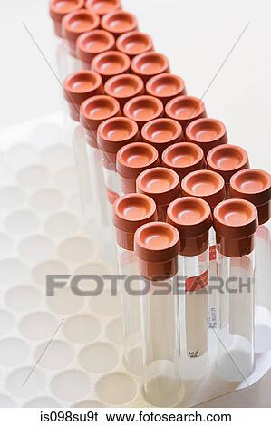 Test tubes View Large Photo Image Stock Photograph - Test tubes. Fotosearch