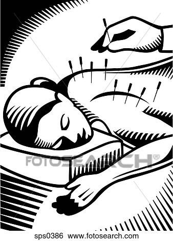 A black and white drawing of a woman getting an acupuncture View Large Illustration Stock Illustration - A black and white drawing of a woman getting an acupuncture. Fotosearch