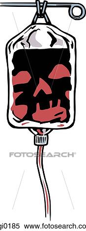 A pictorial representation of an IV bag View Large Illustration Stock Illustration - A pictorial representation of an IV bag. Fotosearch