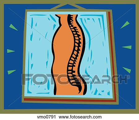 Illustration of a spine View Large Illustration Clip Art - Illustration of a spine. Fotosearch