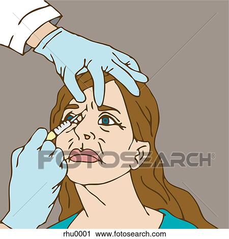 A doctor giving a botox injection to a womans forehead View Large Illustration Clip Art - A doctor giving a botox injection to a womans forehead. Fotosearch