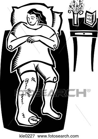 A woman in bed with a broken leg in a cast View Large Illustration Stock Illustration - A woman in bed with a broken leg in a cast. Fotosearch