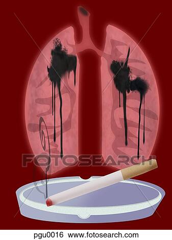 Cigarette on with lungs and tar View Large Illustration Stock Illustration - Cigarette on with lungs and tar. Fotosearch