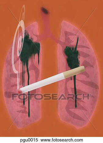 Cigarette with lungs and tar View Large Illustration Stock Illustration - Cigarette with lungs and tar. Fotosearch