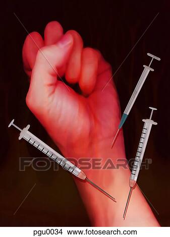 Stock Illustration - Clenched fist surrounded by syringes. Fotosearch