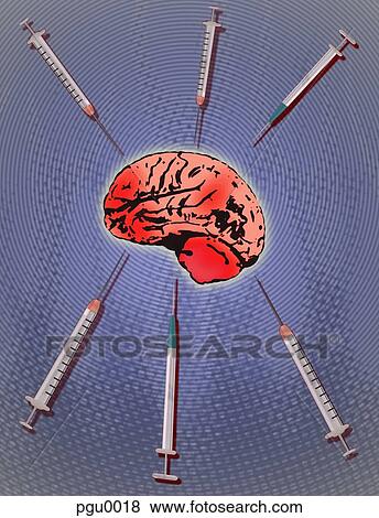 Stock Illustration - Human brain with syringes surrounding it. Fotosearch