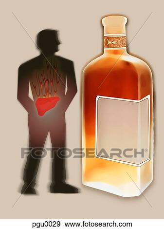 Man with highlighted liver standing next to large bottle of alcohol View Large Illustration Stock Illustration - Man with highlighted liver standing next to large bottle of alcohol. Fotosearch