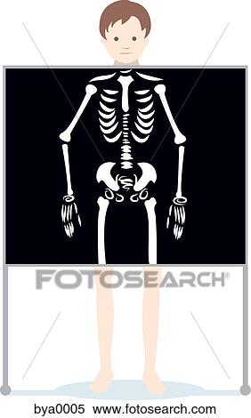 Stock Illustration - A man getting an xray done. Fotosearch