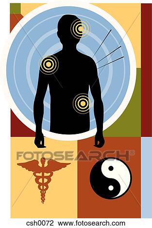 Drawing - acupuncture. Fotosearch