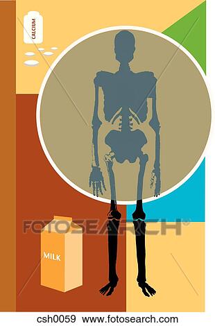 Stock Illustration - Osteoporosis Prevention. Fotosearch
