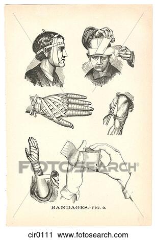A page of illustrations of bandaged injuries from a vintage book View Large Illustration Clip Art - A page of illustrations of bandaged injuries from a vintage book. Fotosearch