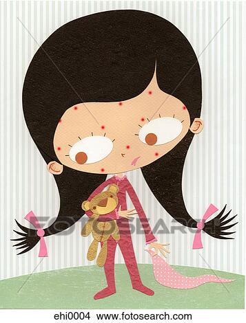 Stock Illustration - A paper cut illustration of a young girl with measles. Fotosearch