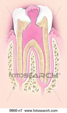 Stock Illustration of Pulp Polyp Unlabeled 9866-n7 - Search EPS Clipart ...