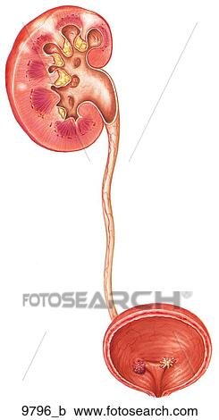 Acute Pyelonephritis Unlabeled View Large Illustration Clipart - Acute Pyelonephritis Unlabeled. Fotosearch