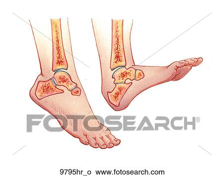 Stock Illustration - Ankle Joint (Cross-Section) Unlabeled. Fotosearch