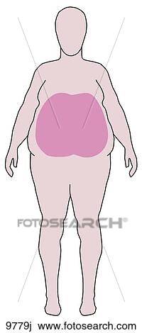 Drawing - Apple Shaped Fat Distribution Unlabeled. Fotosearch