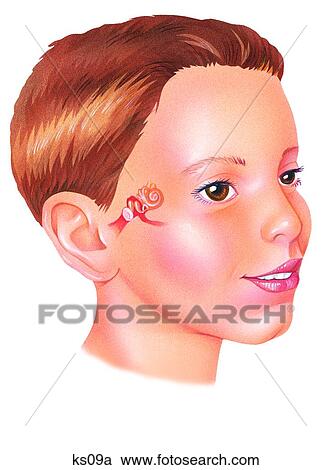 Boy with ear anatomy superimposed on head. View Large Illustration Clipart - Boy with ear anatomy superimposed on head.. Fotosearch