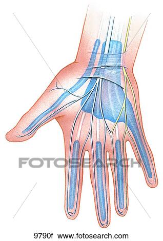 Carpal Tunnel Syndrome Unlabeled View Large Illustration Clip Art - Carpal Tunnel Syndrome Unlabeled. Fotosearch