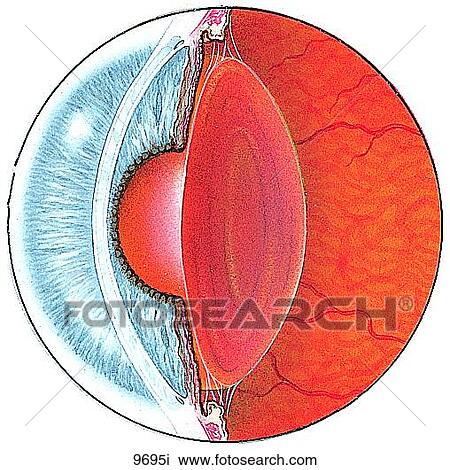 Drawing - Cataract Unlabeled. Fotosearch