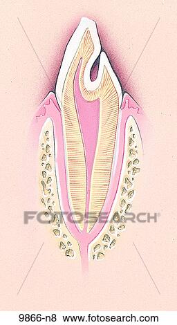 Dens Invaginatus Unlabeled View Large Illustration Stock Illustration - Dens Invaginatus Unlabeled. Fotosearch
