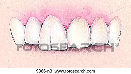Dental Germination Unlabeled View Large Illustration Drawing - Dental Germination Unlabeled. Fotosearch