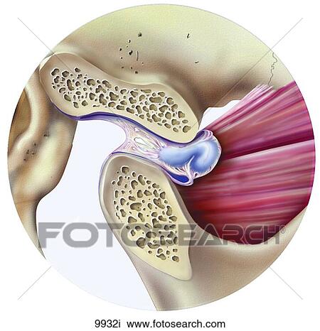 Disc Displacement of TMJ Unlabeled View Large Illustration Drawing - Disc Displacement of TMJ Unlabeled. Fotosearch