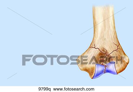 Elbow Fractures Unlabeled View Large Illustration Stock Illustration - Elbow Fractures Unlabeled. Fotosearch