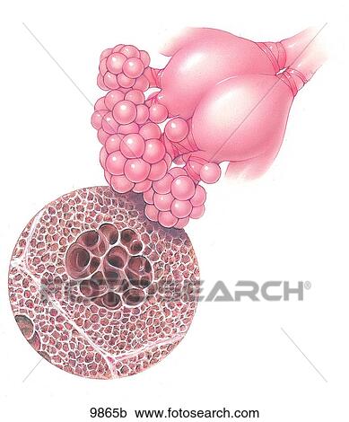 Clipart - Emphysema with Dilation of Bronchiole Walls Unlabeled. Fotosearch