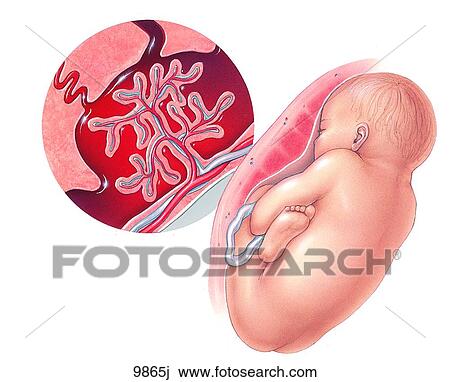 Drawing - Fetal Risk with Smoking Unlabeled. Fotosearch