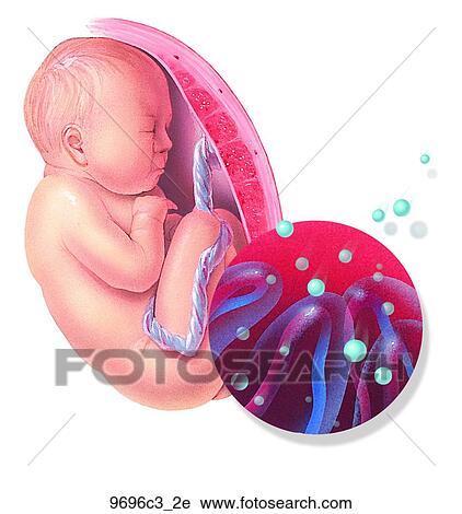 Clip Art - Fetus and Alcohol Syndrome Unlabeled. Fotosearch