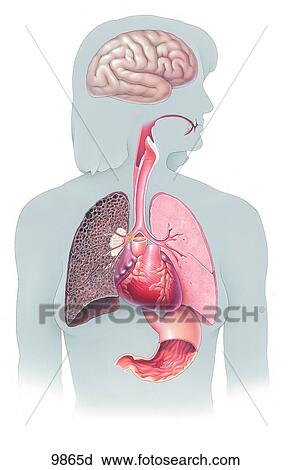 Figure Showing Healthy and Smoker's Lung Unlabeled View Large Illustration Clip Art - Figure Showing Healthy and Smoker's Lung Unlabeled. Fotosearch